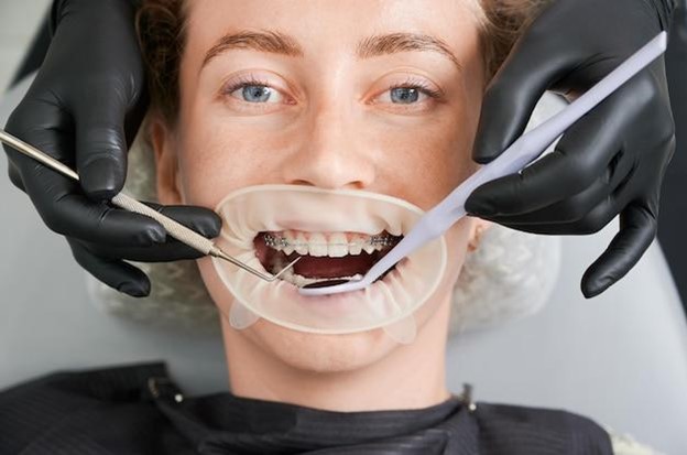Woman having ICE CLEAR Braces tightened by an orthodontist