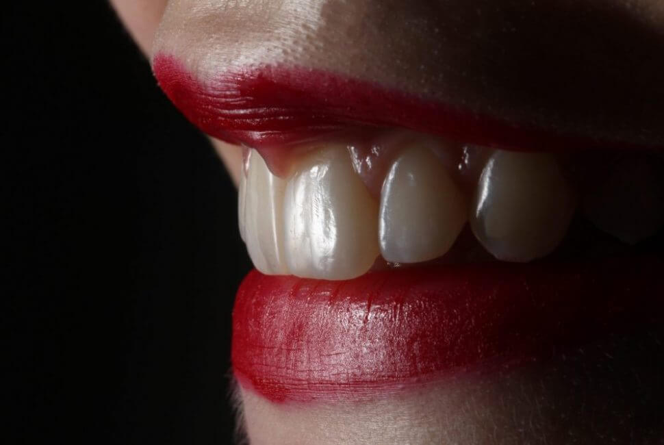 a close up of a woman’s teeth