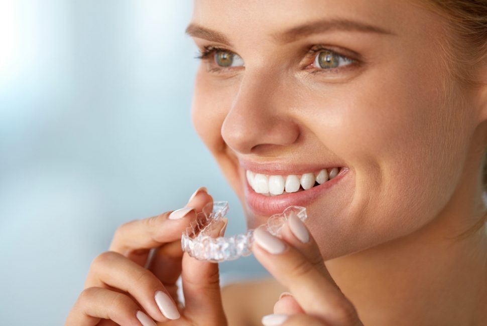 Woman putting her clear aligners